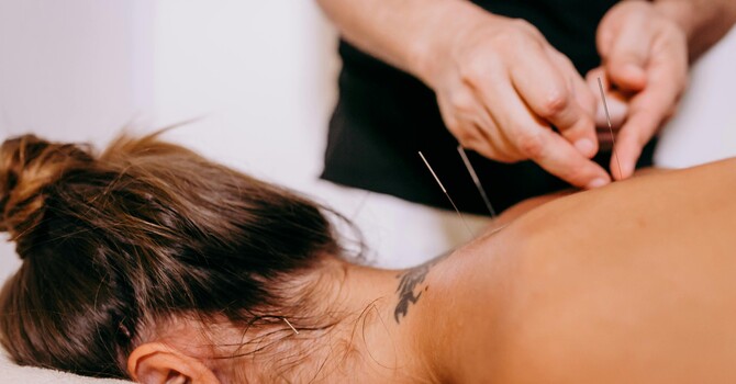 De-Stressing with Acupuncture & Chinese Medicine